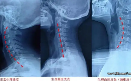 【学习资料】颈椎腰椎部保健完结百度云阿里云下载